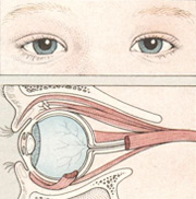 Глазные заболевания и нарушения зрения