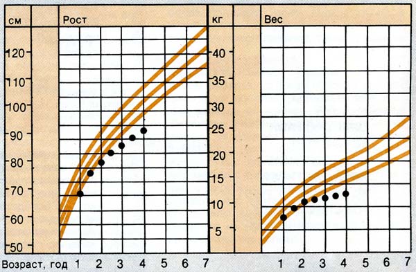 Слишком маленький ребенок