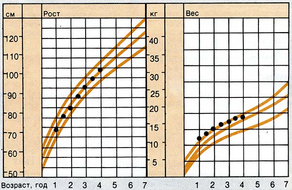 Потеря лишнего веса