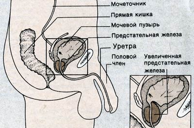 предстательная железа