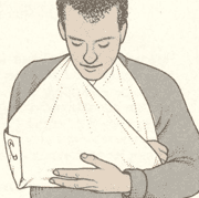 Травма плеча, ключицы или локтя