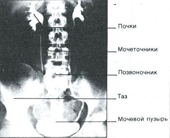 ПИЕЛОГРАФИЯ