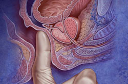 Диагностика  аденомы